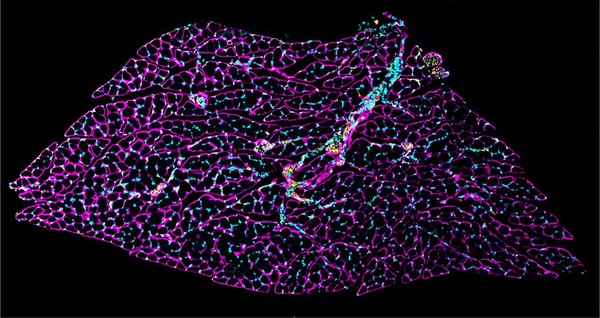 Transverse section through mouse soleus muscle