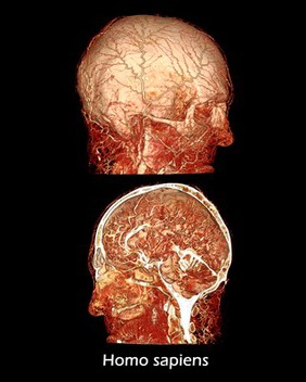 Microvasculature of human head and brain