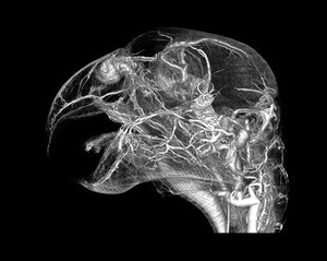 view Microvasculature of grey parrot head