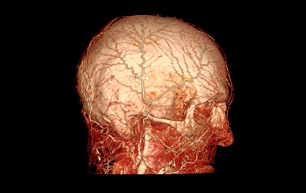 Microvasculature of human head