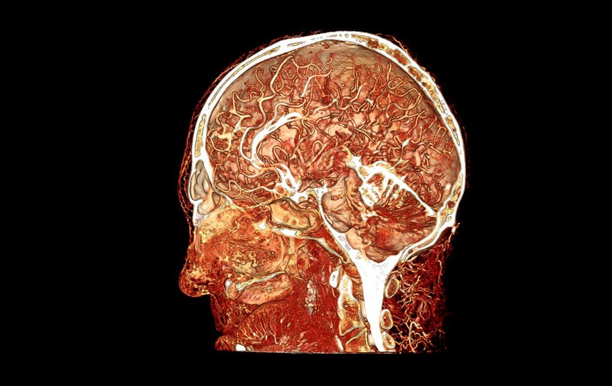 Microvasculature of human head and brain