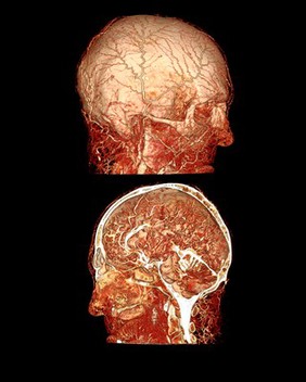 Microvasculature of human head and brain