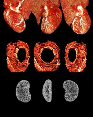 view Microvasculature of rat heart, iris and kidney