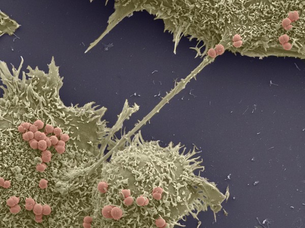 Human epithelial cells colonised by Neisseria cinerea