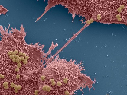 Human epithelial cells colonised by Neisseria cinerea