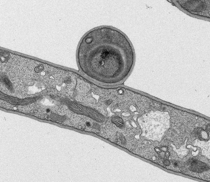 Penicillium chrysogenum spore and hyphae