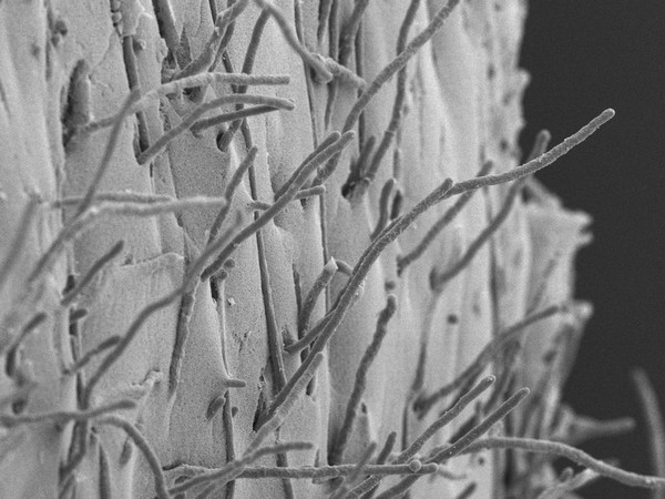 Penicillium chrysogenum hyphae on agar