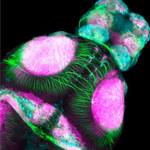 view Dorsal view of zebrafish brain (4 day-post fertilization)