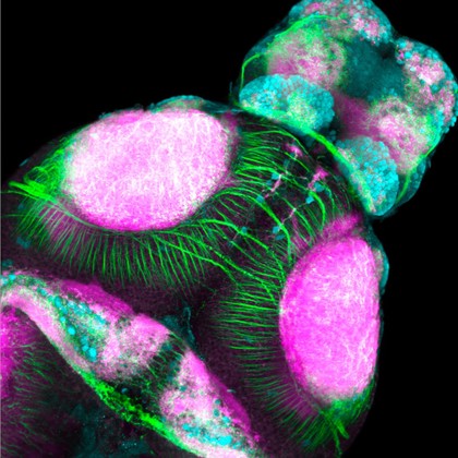Dorsal view of zebrafish brain (4 day-post fertilization)