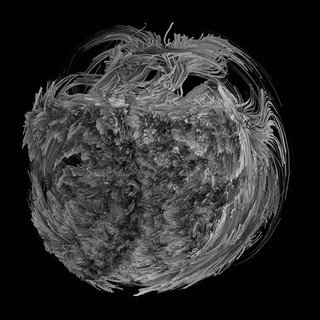 White matter innervation of the neocortex, MRI