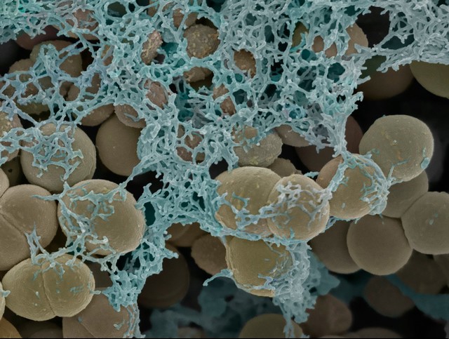 Streptococci gordonii biofilm grown on a dental restorative; imaged by scanning electron microscopy.