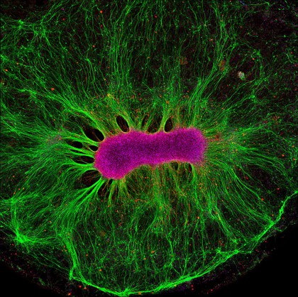 Brain Organoid.