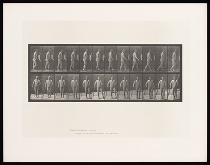 A naked man with hemiplegia walking with a stick: (above) from the side, (below) from the front. Collotype after Eadweard Muybridge, 1887.