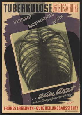 A radiograph of the chest; representing the need for early detection of pulmonary tuberculosis. Colour lithograph by G.C. Schulz, ca. 1947.