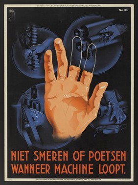 A hand which has lost two fingers, owing to attempts to clean dangerous machines while they are running. Colour lithograph by Jacob Jansma, 1949.