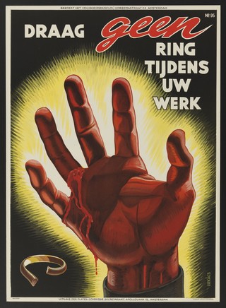 A hand which has suffered a bad wound while in contact with machinery owing to a finger ring which has broken and torn the flesh. Colour lithograph by E. Lukács, 1950.