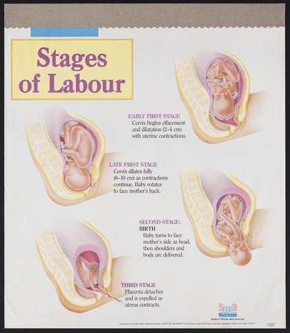Stages of labour / SMA Nutrition.