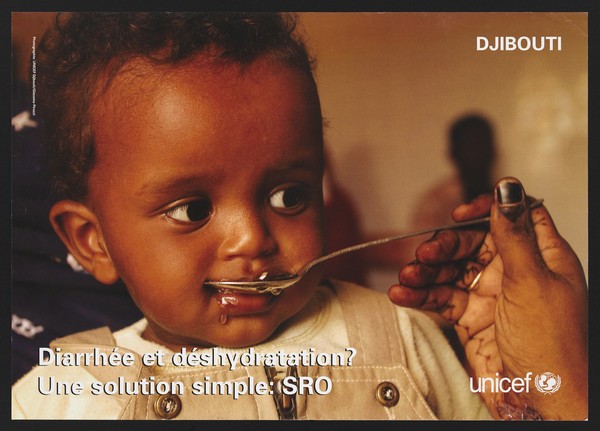 Treating children with diarrhoea in Djibouti. Colour lithograph by Giacomo Pirozzi for Unicef Djibouti, ca. 2000.