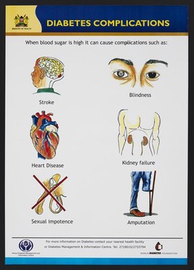 Diabetes complications in Kenya. Colour lithograph by Ministry of Health, ca. 2000.