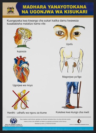 Diabetes complications in Kenya. Colour lithograph by Ministry of Health, ca. 2000.