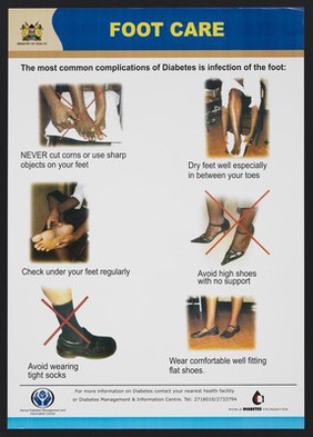 Foot complications related to diabetes in Kenya. Colour lithograph by Ministry of Health, ca. 2000.