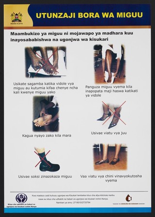 Foot complications related to diabetes in Kenya. Colour lithograph by Ministry of Health, ca. 2000.