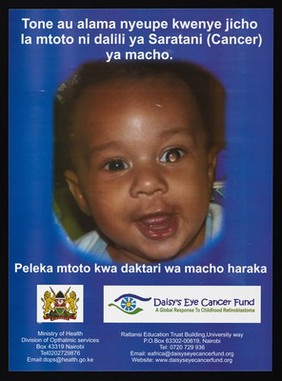 A baby with eye cancer: the daisy eye cancer fund in Kenya. Colour lithograph by the Ministry of Health and Rattansi Education Trust, ca. 2000.