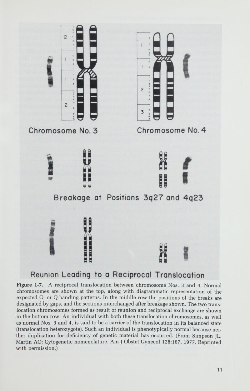 PRINCIPLES OF HUMAN GENETICS / 13 additional chromosome. Thus, a male with trisomy 21 (Down syndrome) is designated 47,XY, + 21; a female with monosomy 21 would be designated 45,XX,-21. Complement containing a structurally abnormal chromosome is designated by (1) the total number of chromosomes, (2) the sex chromosomal complement, (3) the symbol for the particular structural aberration present, and (4) the num¬ ber of the aberrant chromosome. Two systems exist (Table 1-3). In the detailed system, altered chromosomes are defined by their band composition; in the shortened system, altered chromosomes are defined only by their break points. For example, in the shortened system 46,XX,del(5)(q21) indicates that a ter¬ minal deletion occurred at band q21 of No. 5 (i.e., long arm (q), region 2, band 1). The genetic material distal to band 5q21 was lost, with the remaining portion of the 5q consisting of the entire short arm and the portion of the long arm located between the centromere and band q21. In the detailed system the same complement would be designated 46,XX,del(5)(ptei^q21:), i.e., the portion of 5q remaining extends from the terminal (ter) portion of 5p (pter) to band Xq21, where a break without reunion (:) occurred. Standardized methods to designate translocations and other rearrange¬ ments are reviewed elsewhere (Simpson & Martin, 1977). CHROMOSOMAL DIVISION AND REPLICATION Mitosis Mitosis is the process by which daughter cells receive identical copies of the parental genome. Each pair of chromosomes is said to be homologous, i.e., identical with respect to their constituent genetic loci and visible structure. The four parts of a cell cycle are gap 1 (Gl), synthesis (S), gap 2 (G2), and division or mitosis (D). During Gl, usually the longest part of the cell cycle in humans, the cell accumulates nucleotides, amino acids, proteins, and other substances in preparation for replication of its DNA. DNA synthesis occurs during S, at the end of which the DNA content will be doubled. Initially each chromosome consists of a single chromatid; eventually each chromosome will consist of two sister chromatids, joined at the single centromere, with the DNA content doubled. After DNA synthesis is completed, a resting period (G2) lasts until mitosis. The fourth period, division (D) or mitosis, is relatively short. Although it is continuous and lacks well-demarcated points, mitosis is tradi¬ tionally divided into four stages: prophase, metaphase, anaphase, and telophase (Fig. 1-8). Prophase. At the onset of prophase, chromosomes are elongated, there¬ after becoming shorter, more compact, and more darkly staining. Each chro¬ mosome, which has already replicated its DNA prior to prophase, now consists of two sister chromatids; however, by light microscopy a chromosome appears to be composed of only a single unit. Toward the end of prophase a structure called the centriole divides into two daughter centrioles, each of which migrates to opposite poles in preparation for formation of the mitotic spindle, onto which chromosomes will become oriented for division.