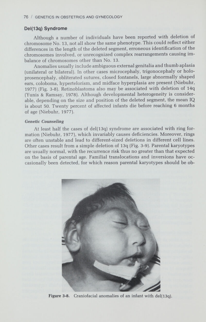 78 / GENETICS IN OBSTETRICS AND GYNECOLOGY familial (Simpson et al., 1979). If parental rearrangements are not present, risks of chromosomally abnormal offspring are those expected on the basis of parental age. Del(21q) Syndrome Deletions of No. 21 have been caused by ring formations, simple deletions, or translocations. Mental retardation, growth retardation, hypertonia, and skel¬ etal, genital, and craniofacial anomalies are frequently present in affected in¬ dividuals. Because of the presence of downward-slanting palpebral fissures, micrognathia, large ears, and prominent nasal bridge, it has been suggested that the del(q21) phenotype is opposite to that of trisomy 21 (so-called contretype). Irrespective of the validity of this concept, malformations are severe and life expectancy short (de Grouchy & Turleau, 1977; Yamamoto et al., 1979). Many cases are associated with familial structural rearrangements, obviously having a relatively high recurrence risk. For cases not associated with such rearrange¬ ments, the risk of a chromosomally abnormal offspring is probably not greater than that expected on the basis of parental age.