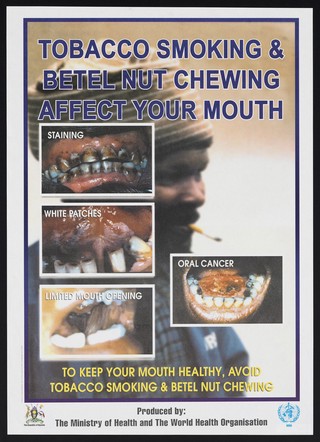 Tobacco and betel nut chewing symptoms in Uganda. Colour lithograph by the Ministry of Health and WHO, ca. 2000.