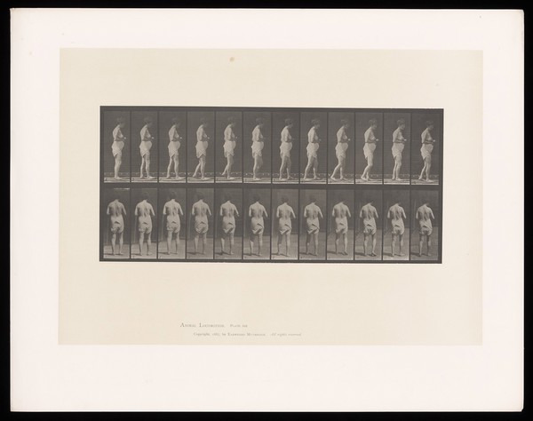 A near-naked woman with multiple sclerosis walking. Collotype after Eadweard Muybridge, 1887.