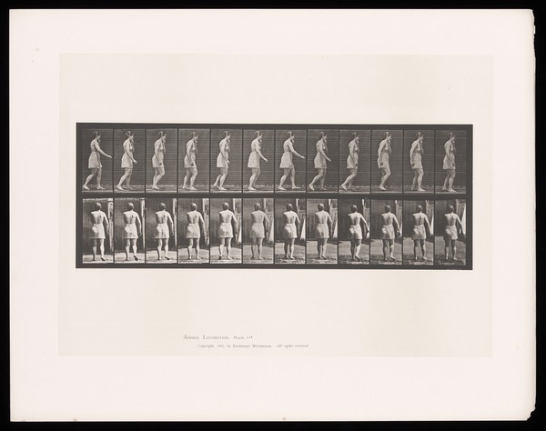 A near-naked woman with cerebral palsy walking. Collotype after Eadweard Muybridge, 1887.