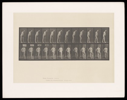 A naked man with hemiplegia, walking with a crutch. Collotype after Eadweard Muybridge, 1887.