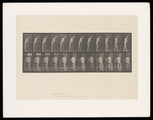 A naked man with hemiplegia, walking with a crutch. Collotype after Eadweard Muybridge, 1887.