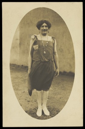 An amateur actor in drag, wearing a flapper dress and white footwear. Photographic postcard, 1925-1928.