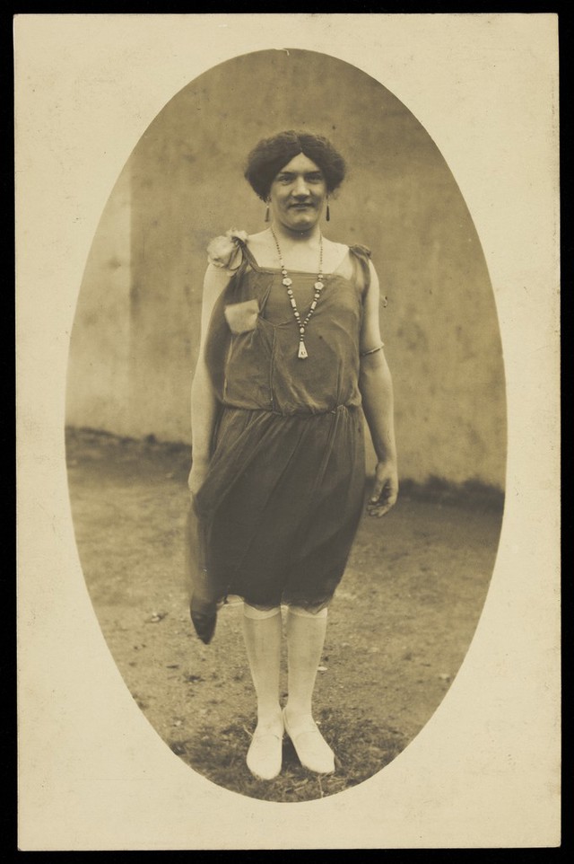 No text description is available for this image