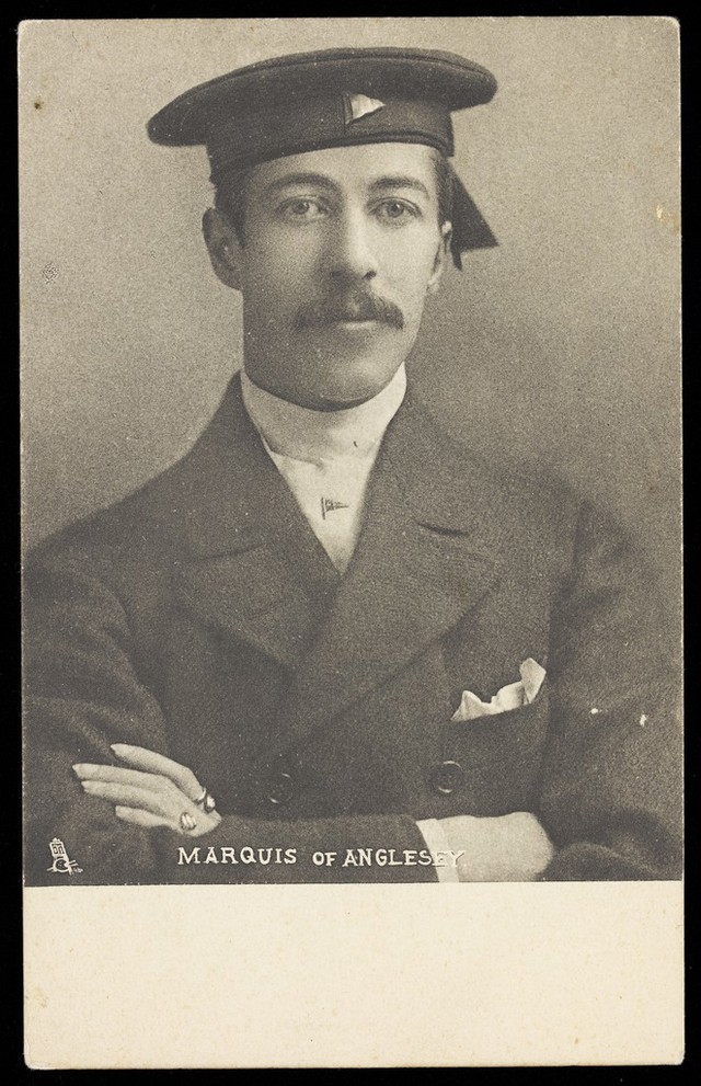 No text description is available for this image