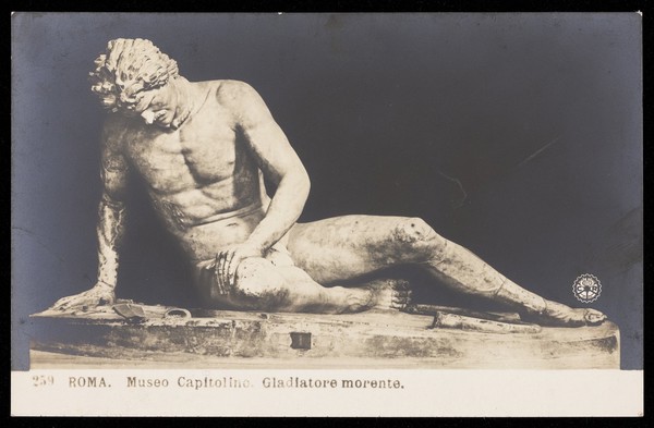 A dying gladiator. Photograpic postcard, 191-.