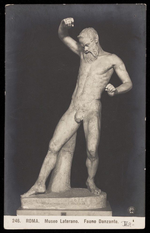 No text description is available for this image