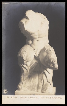 The Belvedere torso. Photographic postcard, 191-.