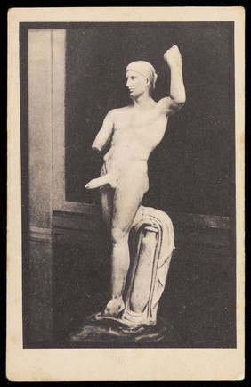 A man holding his arm aloft while sexually aroused. Process print, 193-.