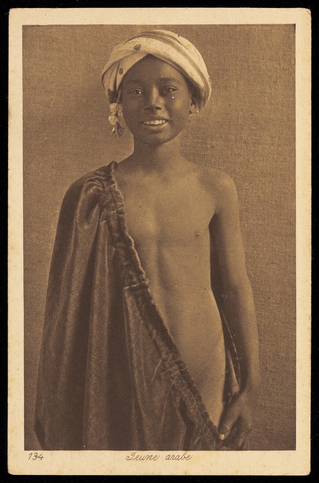 No text description is available for this image