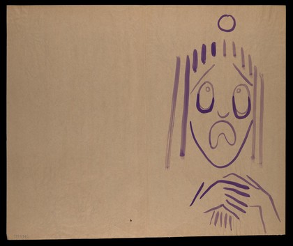 A purple face in distress. Watercolour by M. Bishop, 1977.