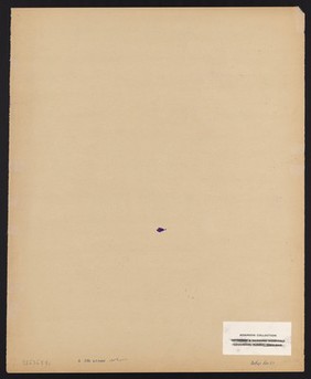 The head of a woman clutching her head in her hands. Watercolour by M. Bishop, 1968.