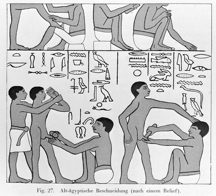 Figures showing a circumcision