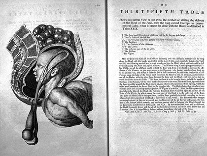 A sett of anatomical tables, with explanations, and an abridgment, of the practice of midwifery, with a view to illustrate a treatise on that subject, and collection of cases / By William Smellie, M.D.