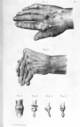 Clinical lectures on senile and chronic diseases / by J.M. Charcot ; translated by William S. Tuke.