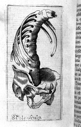 Dissertationes medico-physicae. De antris lethiferis. De Montis Vesuvii incendio. De stupendo ossium coalitu. De immani hypogastrii sarcomate / A D. Bernardo Connor.