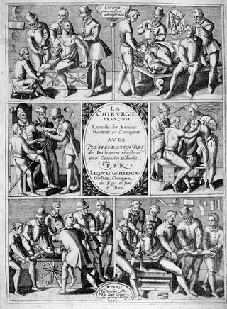 Le chirurgie françoise recueillie des antiens médecins et chirurgiens. Avec plusieurs figures des instrumens necesseres pour l'opération manuelle / Par Iacques Guillemeau.