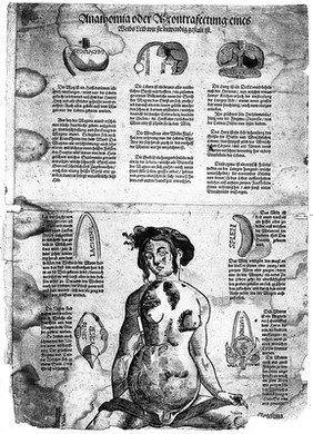 Woodcut, Anatomical Fugitive Sheet.